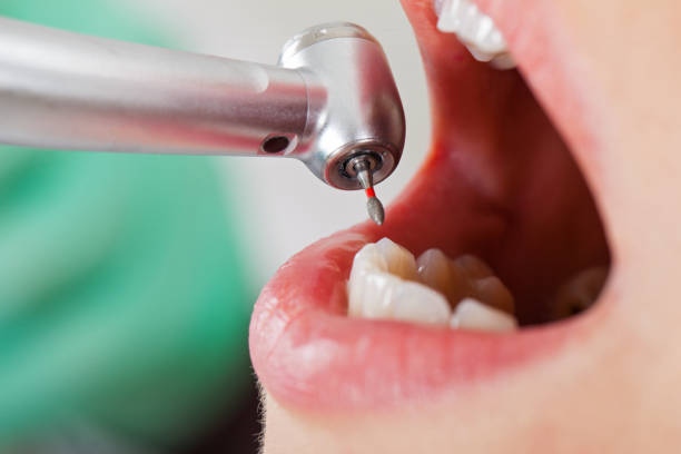 Best Urgent Tooth Repair  in Bradford, OH